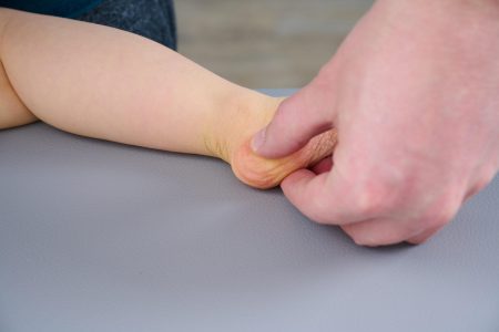 Vojta-Therapie für Kinder